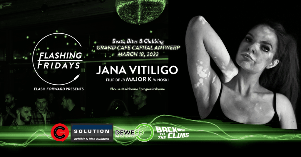 Flashing Fridays /// Jana Vitiligo